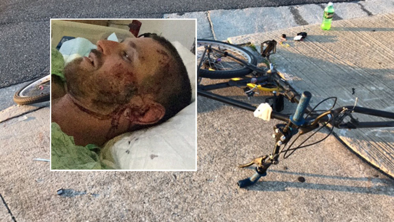 Alachua County Car Crash Alachua County Car Crash