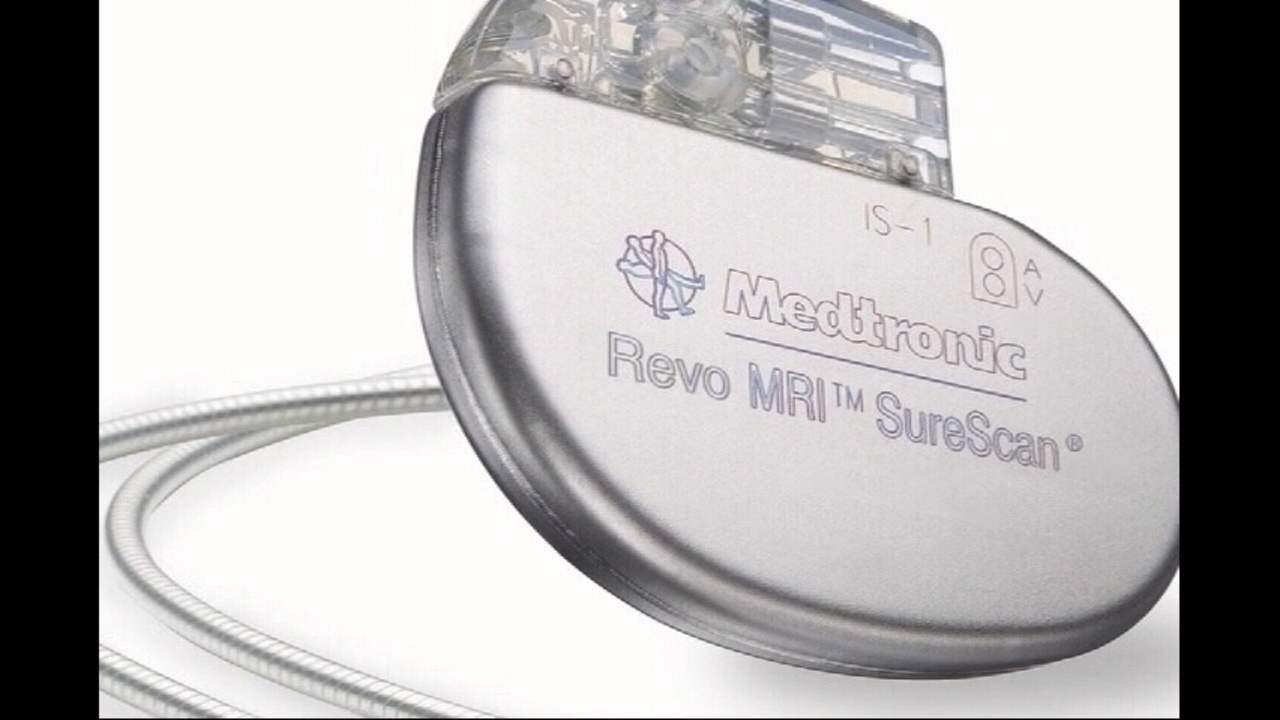 MRIsafe pacemakers now available
