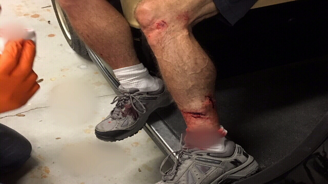 03-19-18 DOG BITE 1_1521515294976.jpg.jpg